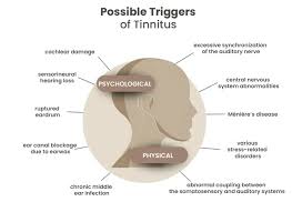 Image result for Tinnitus