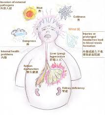 Chinese Medicine Views On The Development Of Headaches