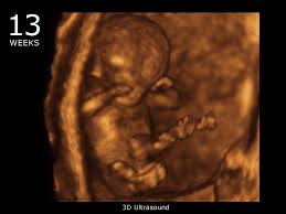 Pin On Baby Development Week By Week