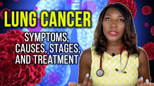 1 ﻿ for this reason, and because there isn't yet a screening test available for never smokers, lung cancers are frequently diagnosed in more advanced stages of the disease. Lung Cancer Symptoms Causes Stages And Treatment