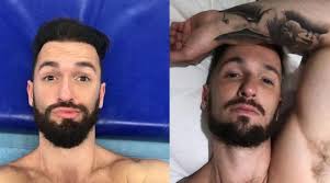 A bichectomia ou cirurgia de redução de bochechas , virou uma verdadeira febre entre as celebridades, e cada vez mais vem conquistando o grande público. Harmonizacao Facial Em Homens Saiba Quais Famosos Fizeram