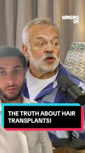 Rio Ferdinand Hair Transplant: The Amazing Hairline Aftermath