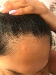 However, those bugs you see could possibly be grain insects, such as weevils, fleas, pill bugs, or centipedes. Princess Cruises Responds After Marriage Story Star Sues For Bedbugs