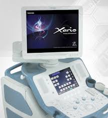 El ecodoppler cardíaco es una técnica básica para el estudio de la anatomía y del funcionalismo cardiaco. Diagnostico Medico Orono Ecografia Eco Doppler Color
