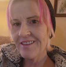 Fibromyalgia symptoms after tests