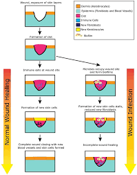 Larger, deeper wounds may take 2 weeks or longer for the wound to heal completely and the scab to disappear. From Ouch To Ah Ha Understanding Wounds Healing And Infections Frontiers For Young Minds