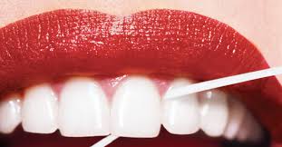 This occurs when tissue starts to die and waste away. How To Fix Receding Gums Newbeauty
