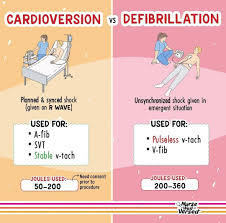 Image result for Synchronized Cardioversion