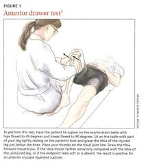 Image result for Lever Test