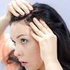 Penyebab kulit kepala gatal umumnya adalah ketombe atau dermatitis seboroik. Https Encrypted Tbn0 Gstatic Com Images Q Tbn And9gcqz9unozjdwsygehxn99mge5ibzpwfxn6ang2 1dr42jxcratsb Usqp Cau