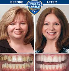 Smile Makeover Contest Winner