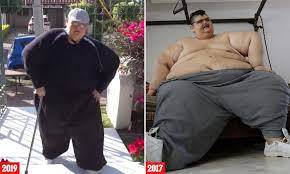 Etter at borgerkrigen var over i 1939, styrte franco spania frem til han døde 20. Former World S Fattest Man Is Back On His Feet After Losing An Incredible 52 Stone In Three Years Daily Mail Online