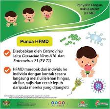 Unit keselamatan dan kualiti makanan. Penyakit Tangan Kaki Dan Mulut Hfmd Pusat Kesihatan Universiti