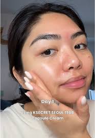 Brighten dark spots fast with the SEOUL 1988 Capsule Cream ✨ Niacinamide 5%  + Yuja = glow, hydration, and a smoother, more even tone. Perfect for daily  use and gentle