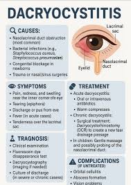 Image result for Dacryoadenitis