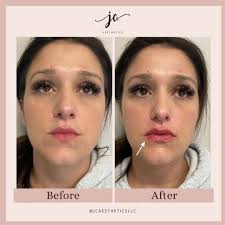 Lemmon Avenue Atlanta