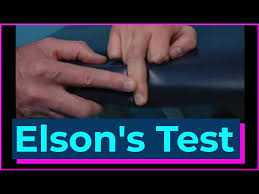 Image result for Elson Extensor Tendon Test