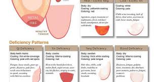 Traditional Chinese Medicine Tongue Diagnosis Charts Album