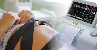 Bebeğin kalp atışlarının seyrini, bebek hareketleriyle ve varsa kasılmalarla olan ilişkisini temel alarak bebeğin iyilik halini değerlendiren bir testtir. Nst Nedir