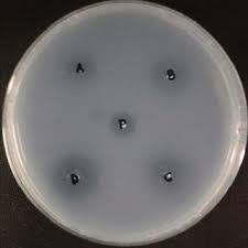 The malaysian journal of microbiology (mjm) is planned to highlight the status of microbiology in malaysia and also as a platform to disseminate knowledge and microbiology research activities in malaysia. Pdf Malaysian Journal Of Microbiology Isolation And Identification Of Fibrinolytic Protease Producing Microorganisms From Red Oncom And Gembus Indonesian Fermented Soybean Cakes