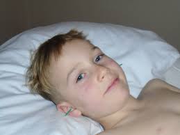 Pediatric Acupuncture /Shoni-Shin Treatment