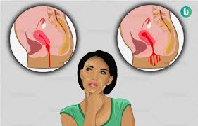 Implantation Bleeding Color Timing Symptoms Implantation Bleeding Vs Periods