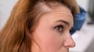 Marta León, ingeniera química: “Tu cabello depende de tus hormonas y  también de lo que comes”