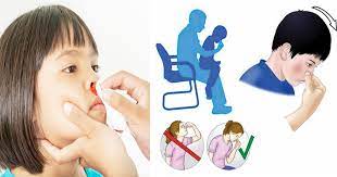 Epistaxis) atau mimisan adalah satu keadaan pendarahan dari hidung yang keluar melalui lubang hidung. 4 Langkah Ibu Bapa Perlu Buat Jika Hidung Anak Berdarah Vanilla Kismis