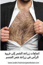 وجود شعر كثيف لامع هو نعمة لأنه هو رصيد كبير من شخصيتنا وبصرف النظر عن الرأس هناك شعر إضافي على بعض أجزاء الجسم الأخرى مثل الوجه و hair transplant blog hair
