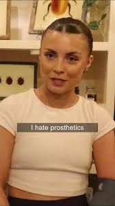 It’s not like your normal prosthetic… Gemma tries a prosthetic arm for the  first time in over 10 years and is blown away by Koalaa’s comfortable,  lightweight and modern approach to assistive ...