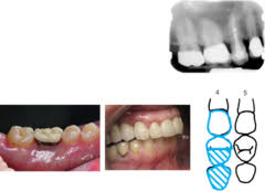 Test Dental Charting Quizlet