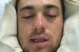 Justin-Thomas-Wisdom-Teeth