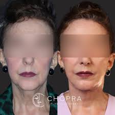 Welcome to another episode of Myth-Busting Fridays! 🧐 Myth: Labiaplasty is  only for aesthetic reasons. 💡 Truth: While it's a cosmetic procedure,  labiaplasty offers real functional benefits that patients love. Let's break