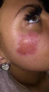 Îți doresc să radiezi de fericire, să îi luminezi pe cei dragi cu bunăvoința ta, să învingi ușor provocările vieții. Tanara De 17 Ani Care Traieste Un Adevarat Cosmar A Ramas Cu Arsuri Pe Fata Dintr Un Motiv Pur Si Simplu Incredibil Ce S A Intamplat