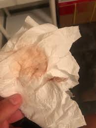 Having a little amount of brown discharge during pregnancy is common and isn't a big cause for concern, but you have to be careful because it can also mean infections, changes in ph or cervix dilation, for example. Light Pink Discharge