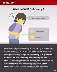Image result for G6PD Deficiency