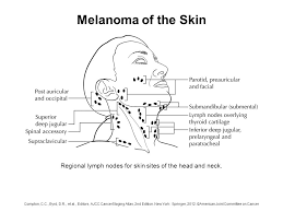 The cancer does not involve the lymph nodes, and it has not spread. Melanoma Of The Skin Regional Lymph Nodes For Skin Sites Of The Head And Neck Compton C C Byrd D R Et Al Editors Ajcc Cancerstaging Atlas 2nd Ppt Download
