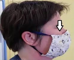Fabrication De Masques L Entreprise Basgter Et La Ville De La Ferte Mace S Associent Le Publicateur Libre Bansal hospital | super speciality hospital. fabrication de masques l entreprise