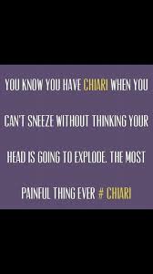 Pin On Chairi Malformation