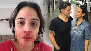 Trt haber ana haber bülteni 05.09.2018. Hazim Kormukcu Zeynep Tandogan A Siddet Uyguladi A Haber Son Dakika Magazin Haberleri