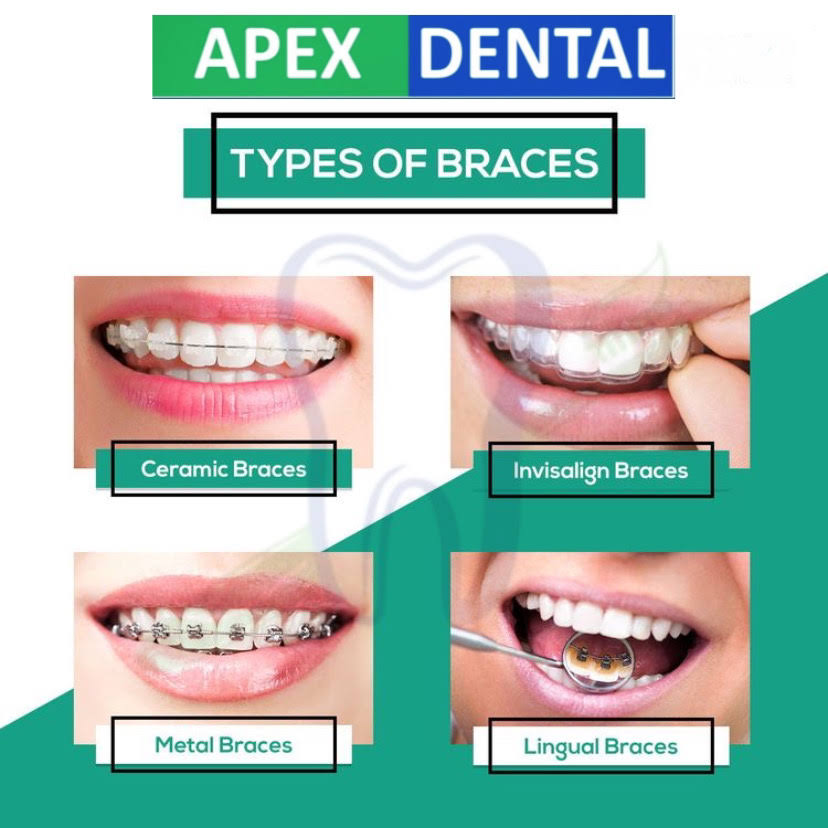 Orthodontic product image
