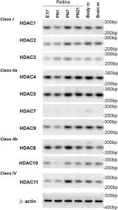 She broke the law for the boss she fell in love with. Histone Deacetylase 1 Is Essential For Rod Photoreceptor Differentiation By Regulating Acetylation At Histone H3 Lysine 9 And Histone H4 Lysine 12 In The Mouse Retina Journal Of Biological Chemistry