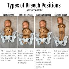 4 Exercises to Flip Your Breech Baby Head Down! - MamasteFit