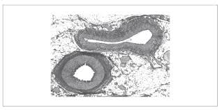 Blood pumping organ, which pumps blood to the lungs and around the rest of the body.; 2