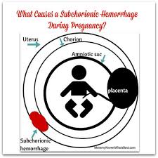 Pin On Improving Fertility