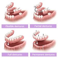 Image result for dentures