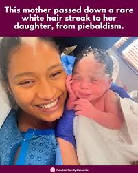 Some things are passed down through generations that go beyond just  memories. This mother passed down a rare white hair streak, a distinctive  mark from piebaldism, to her daughter. A beautiful link