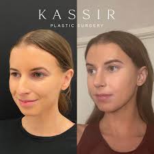 Brow Lift NYC vs Upper Blepharoplasty NYC: Understanding the Difference —  Kassir Plastic Surgery in NY and NJ