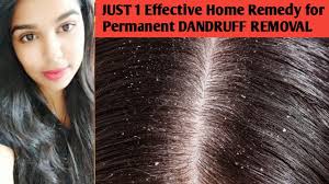 home remes for dandruff in tamil