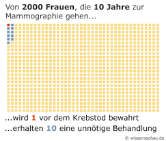 Website des national cancer institute. Fruherkennung Bei Brustkrebs Nicht Ohne Risiko Wissensschau De